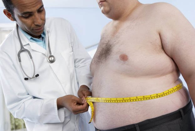 Bariatric Surgery