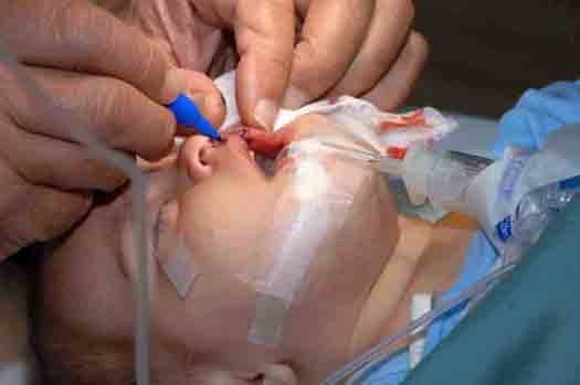 recunstructive_surgery